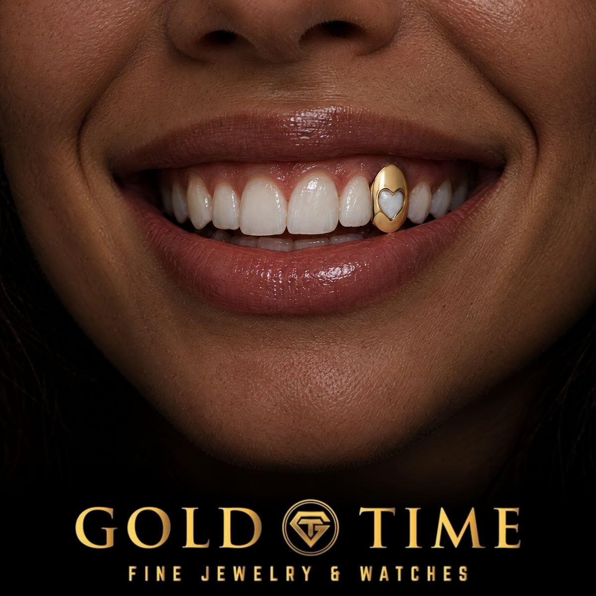 Custom grillz, Single Cap with Heart Cut-Out, worn in a smile, lifestyle photo 1, Gold Time