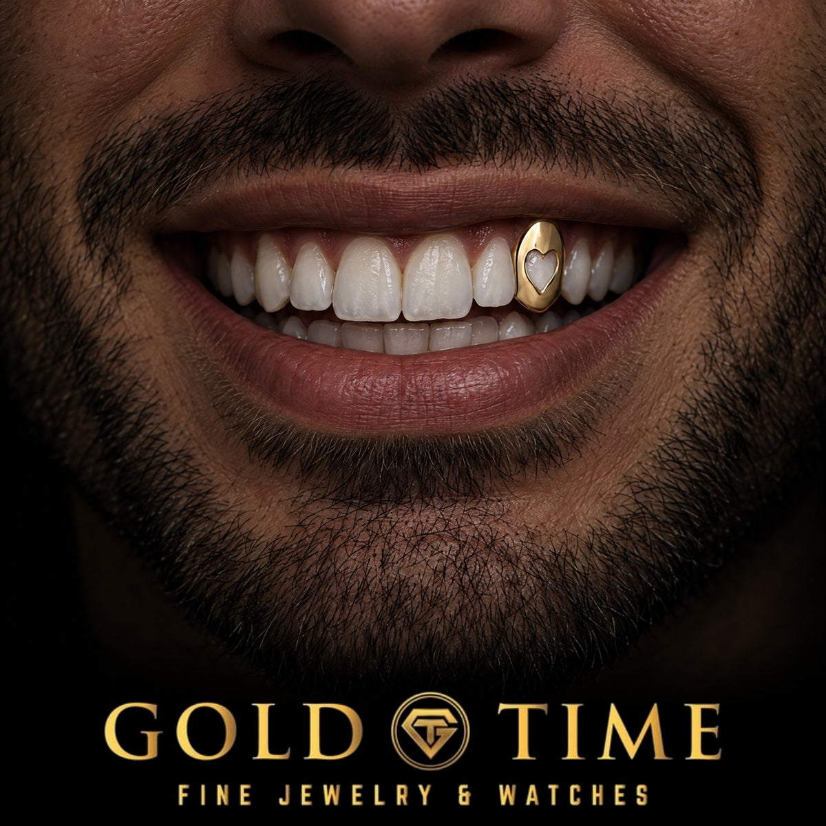 Custom grillz, Single Cap with Heart Cut-Out, worn in a smile, lifestyle photo 2, Gold Time