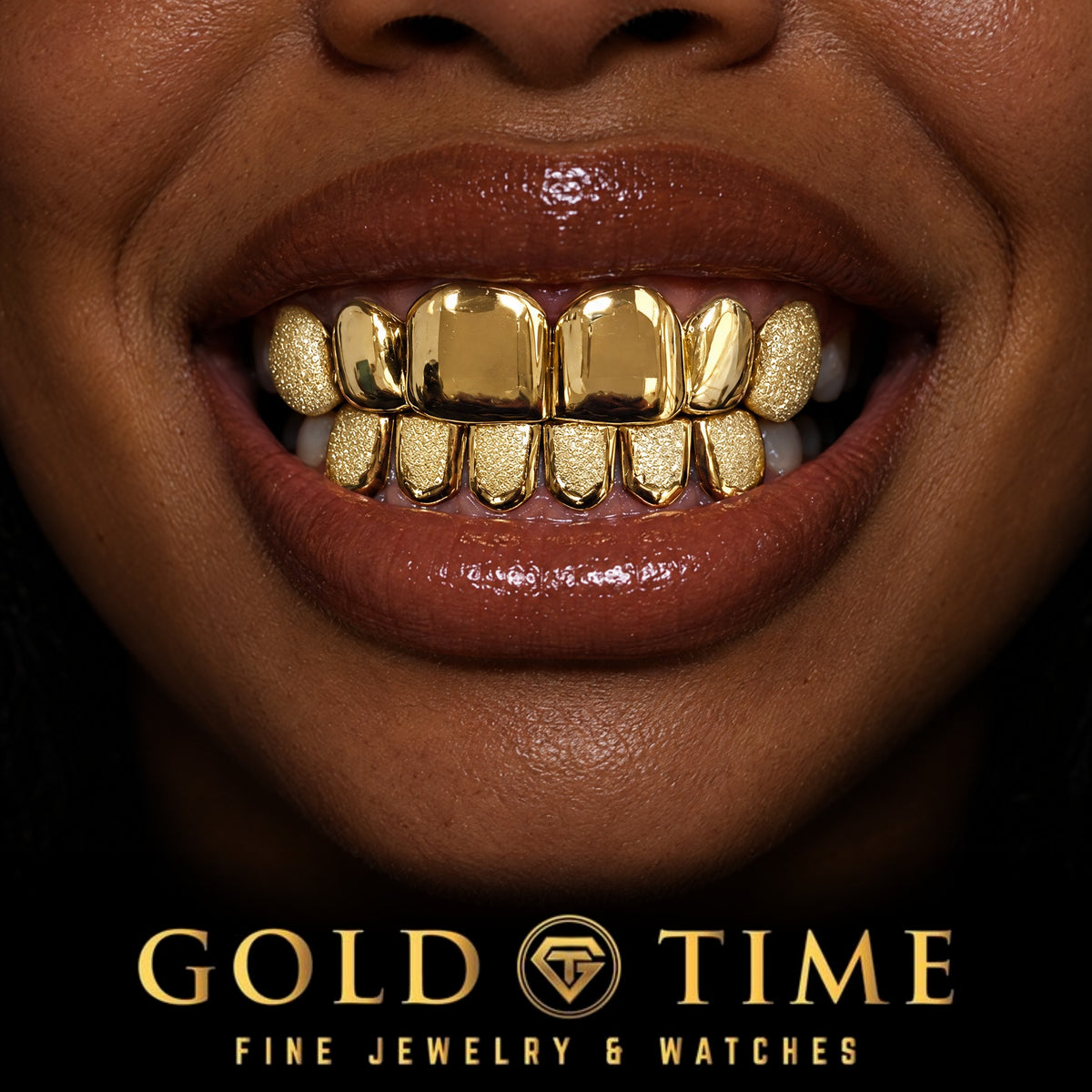 Custom grillz, 12 Piece Perm Cut, Classic and Dust Combo, worn in a smile, lifestyle photo 2, Gold Time