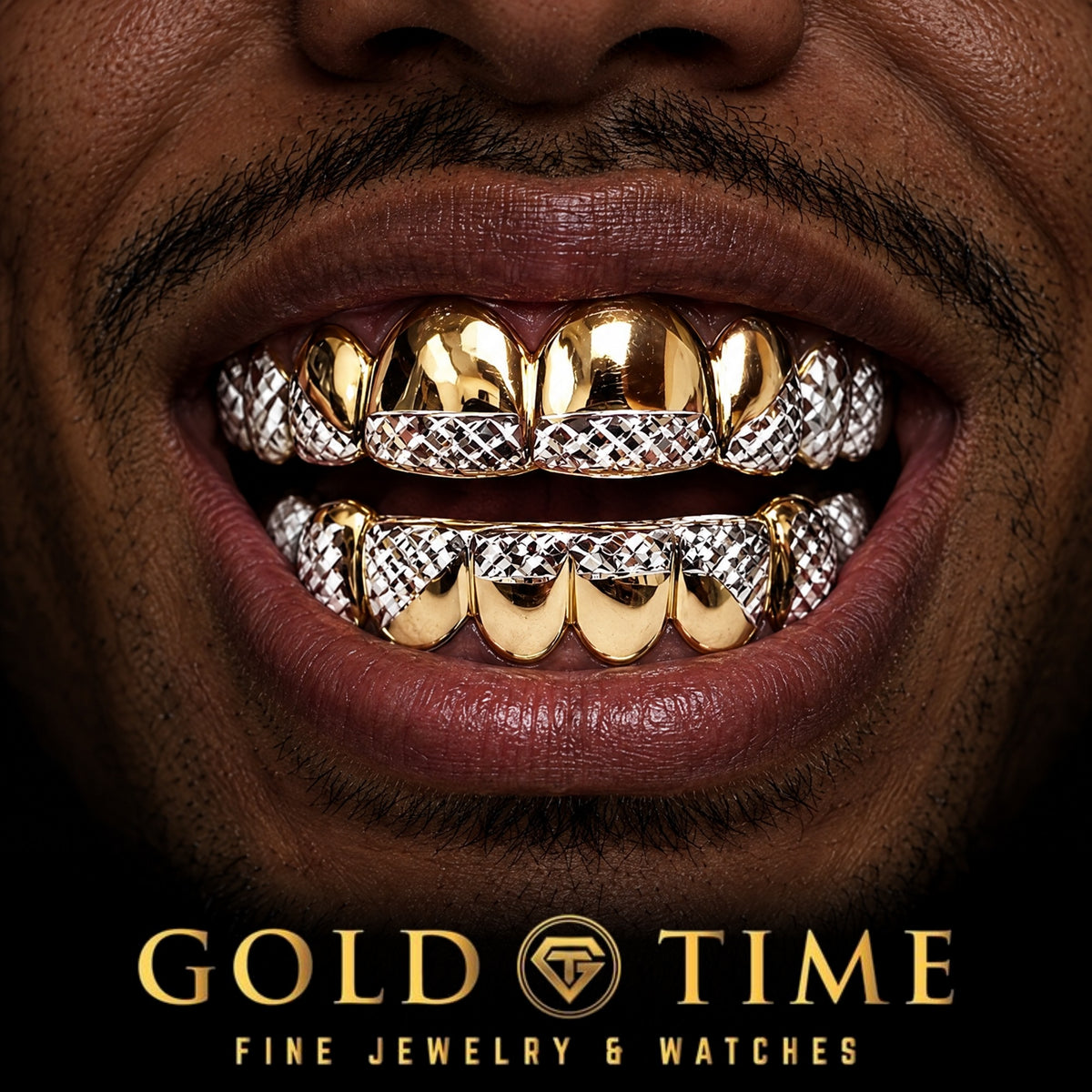 Custom grillz, Two-Tone, White Trillion Tips, worn in a smile, lifestyle photo 1, Gold Time