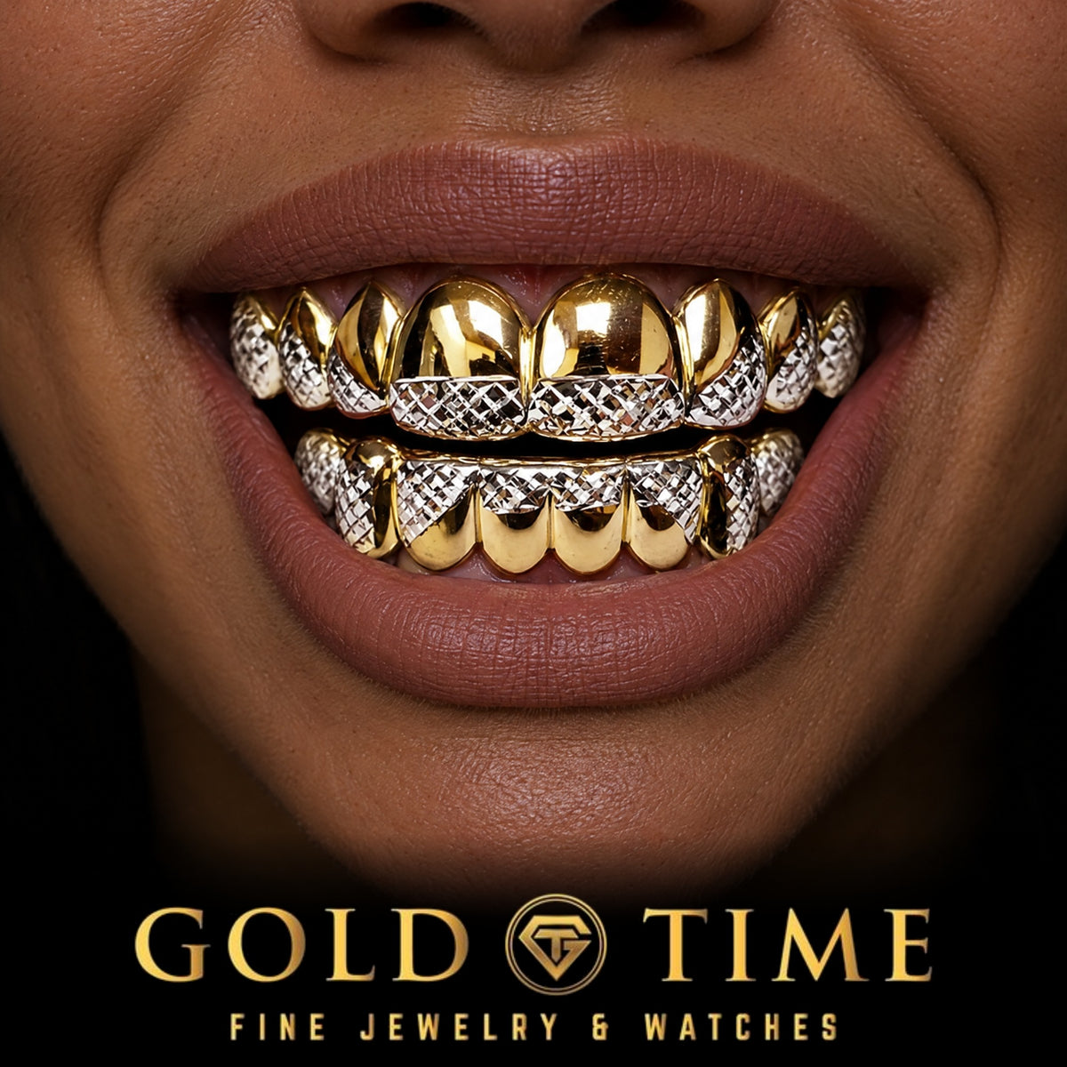 Custom grillz, Two-Tone, White Trillion Tips, worn in a smile, lifestyle photo 2, Gold Time