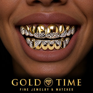 Custom grillz, Two-Tone, White Trillion Tips, worn in a smile, lifestyle photo 2, Gold Time