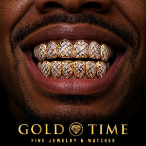 Custom grillz, 12 Piece Two-Tone Trillion Diamond Dust, worn in a smile, lifestyle photo 1, Gold Time