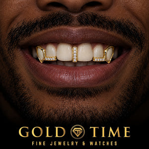 Custom grillz, Hip Hop Open Face Fangs, Moissanite Tips, Gap Bar, worn in a smile, lifestyle photo 1, Gold Time