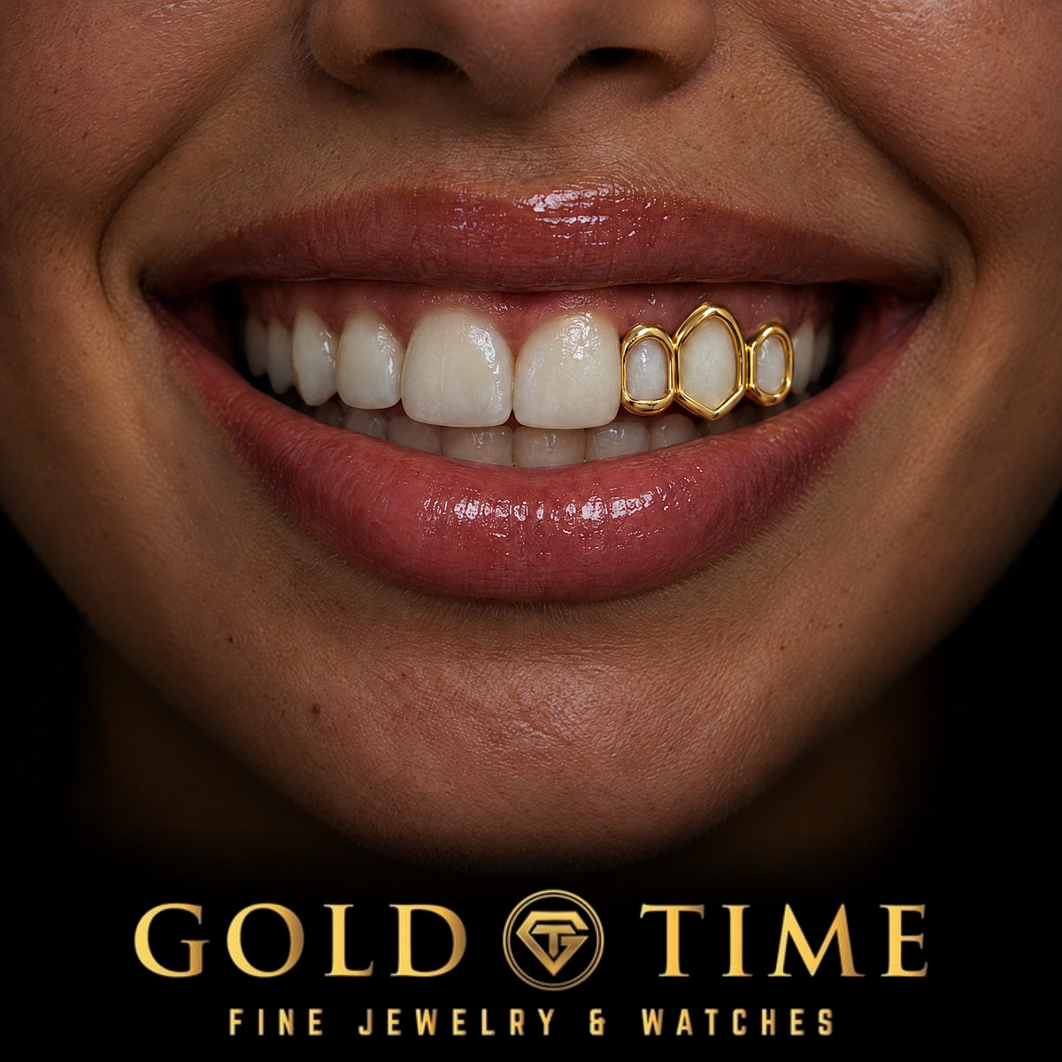 Custom grillz, Open Face Triple Cap, worn in a smile, lifestyle photo 1, Gold Time