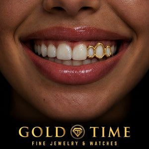 Custom grillz, Open Face Triple Cap, worn in a smile, lifestyle photo 1, Gold Time