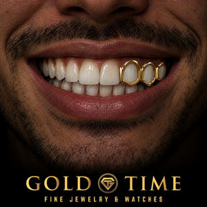 Custom grillz, Open Face Triple Cap, worn in a smile, lifestyle photo 2, Gold Time