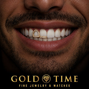 Custom grillz, Moissanite Double Cap, Open Face and Tip, worn in a smile, lifestyle photo 1, Gold Time