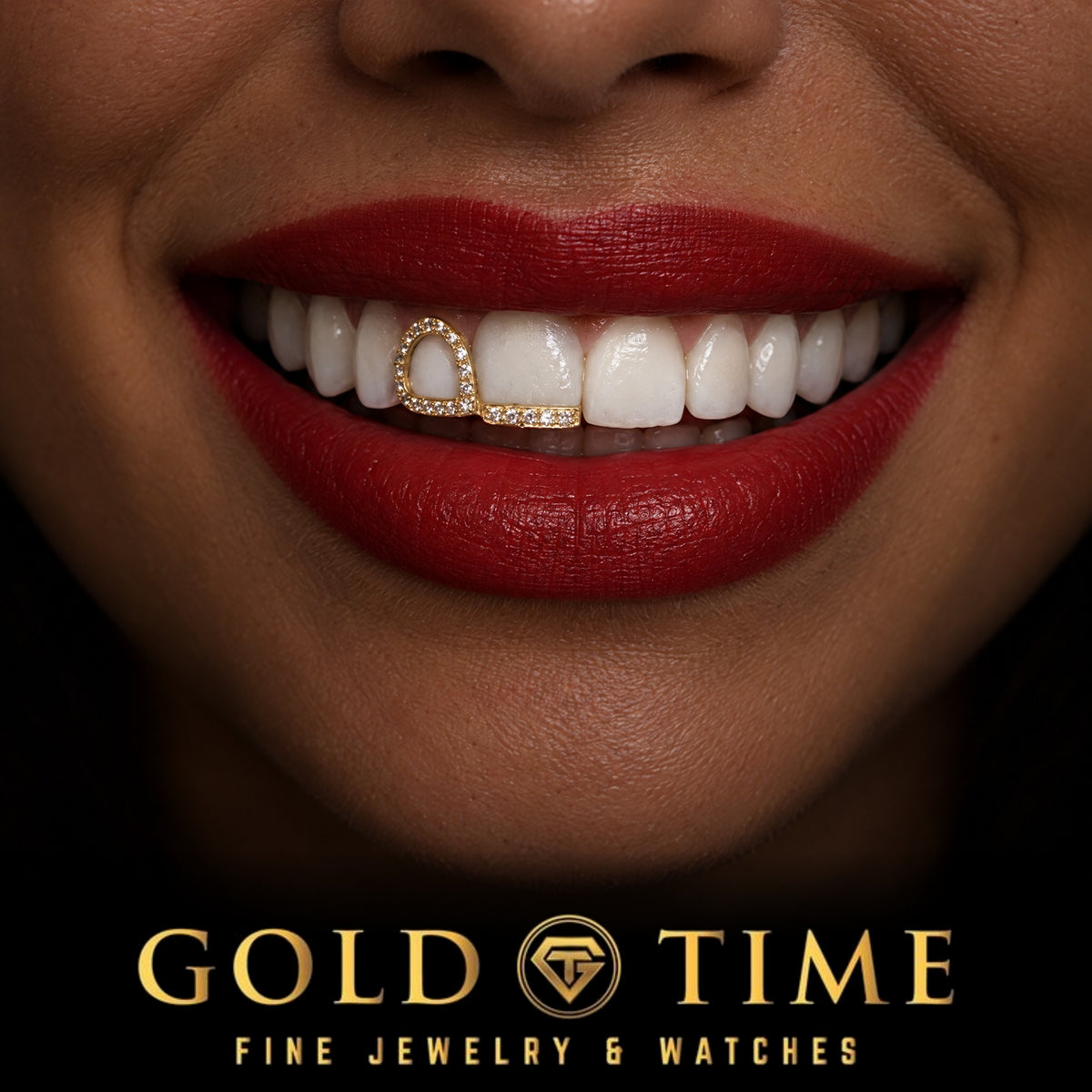 Custom grillz, Moissanite Double Cap, Open Face and Tip, worn in a smile, lifestyle photo 2, Gold Time