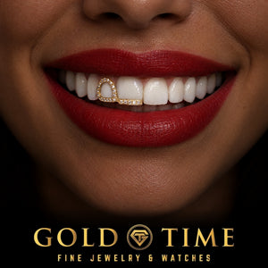 Custom grillz, Moissanite Double Cap, Open Face and Tip, worn in a smile, lifestyle photo 2, Gold Time