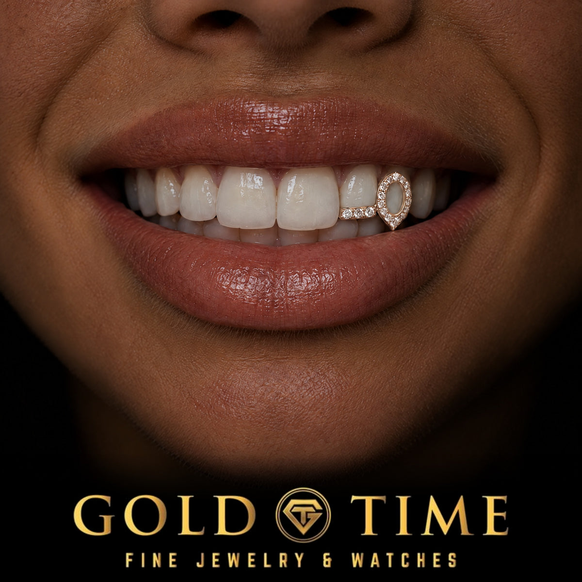 Custom grillz, Iced Open Face Fang and Moissanite Tip Double Cap, worn in a smile, lifestyle photo, Gold Time