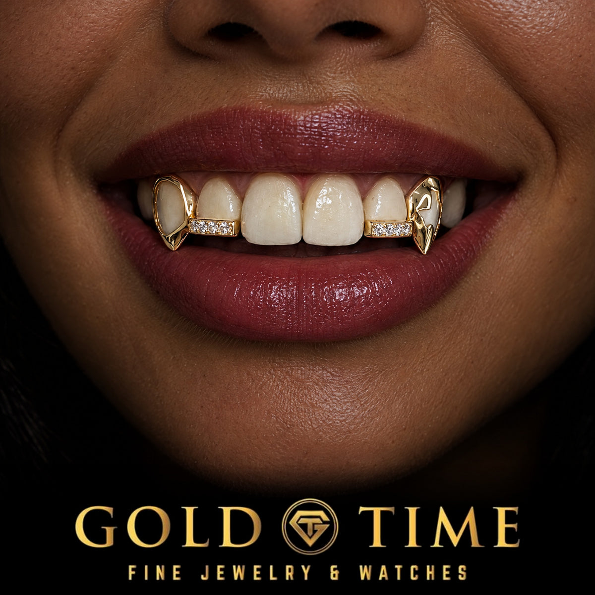 Custom grillz, 4 Piece Open Face Fangs, Cut-Out, Moissanite Tips, worn in a smile, lifestyle photo 2, Gold Time