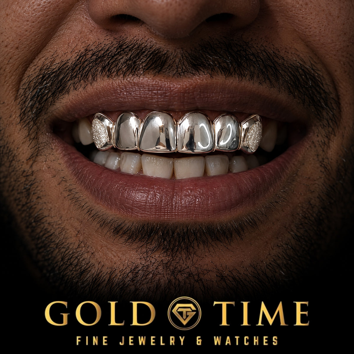 Custom grillz, 6 Piece Diamond Dust Box Canines, Perm Cuts, worn in a smile, lifestyle photo 1, Gold Time
