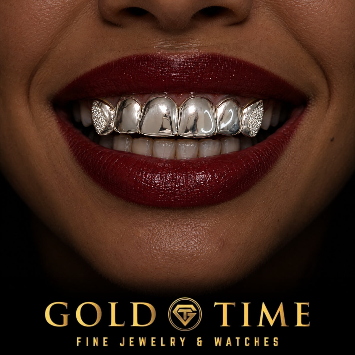 Custom grillz, 6 Piece Diamond Dust Box Canines, Perm Cuts, worn in a smile, lifestyle photo 2, Gold Time