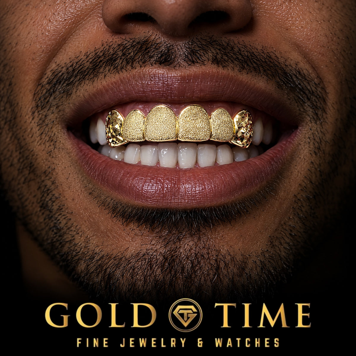 Custom Luxury Diamond Dust Grillz, Trillion Canines, 6 Piece, worn in a smile, lifestyle photo 1, Gold Time