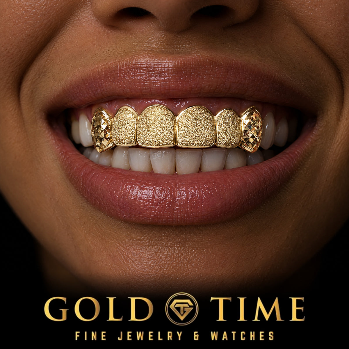 Custom Luxury Diamond Dust Grillz, Trillion Canines, 6 Piece, worn in a smile, lifestyle photo 2, Gold Time