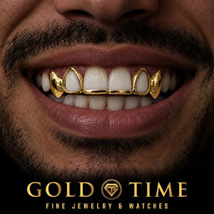 Custom grillz, 6 Piece Solid Tip Bar, Open Face and Solid Canines, worn in a smile, lifestyle photo 1, Gold Time