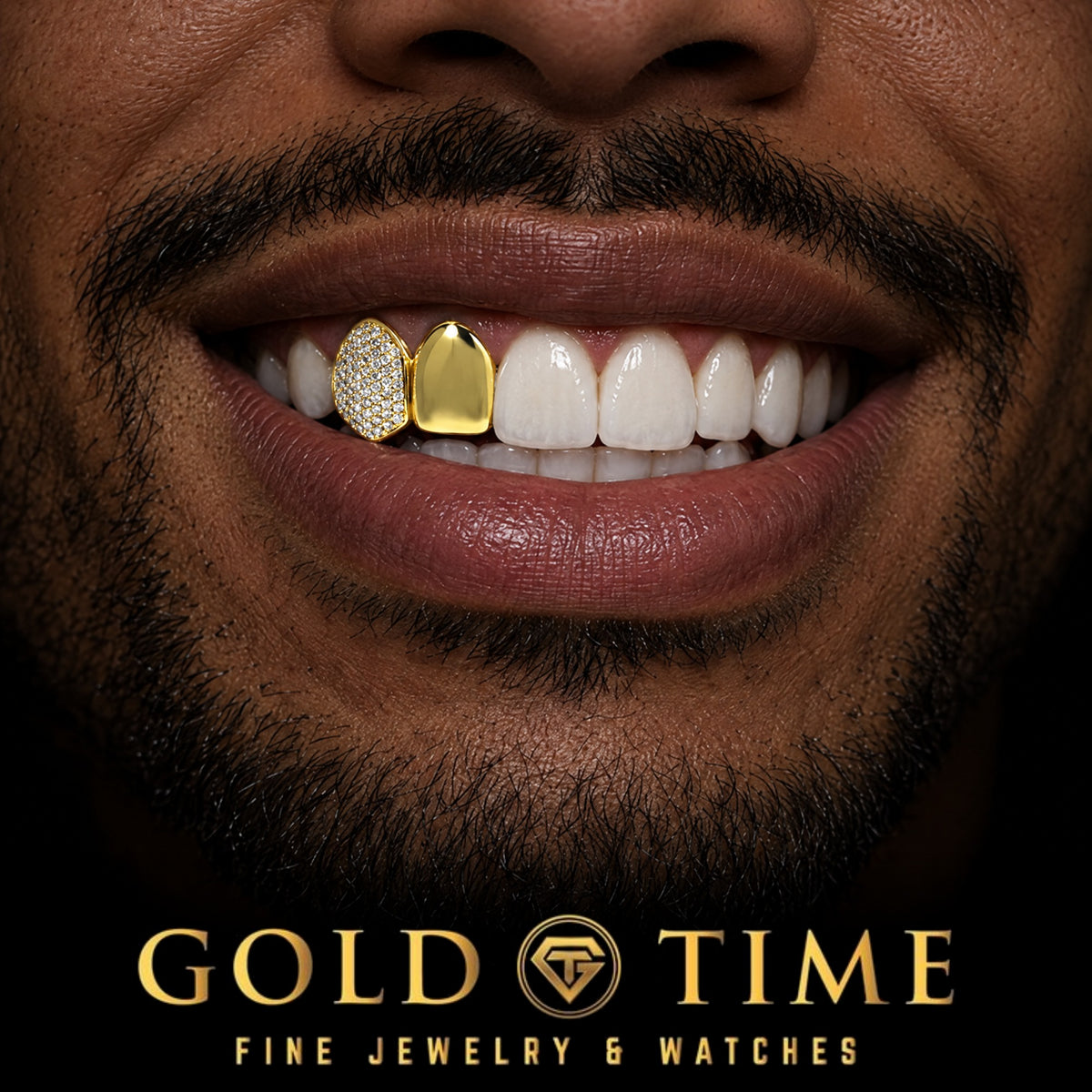 Custom grillz, Double Cap, Solid Incisor and Iced Honeycomb, worn in a smile, lifestyle photo 1, Gold Time