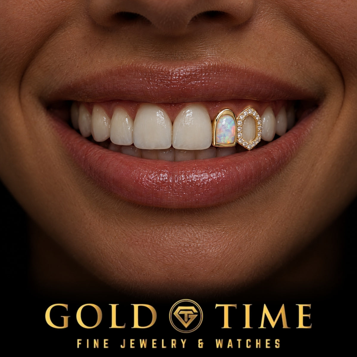 Custom grillz, Double Cap, Synthetic Opal and Moissanite Fang, worn in a smile, lifestyle photo 1, Gold Time