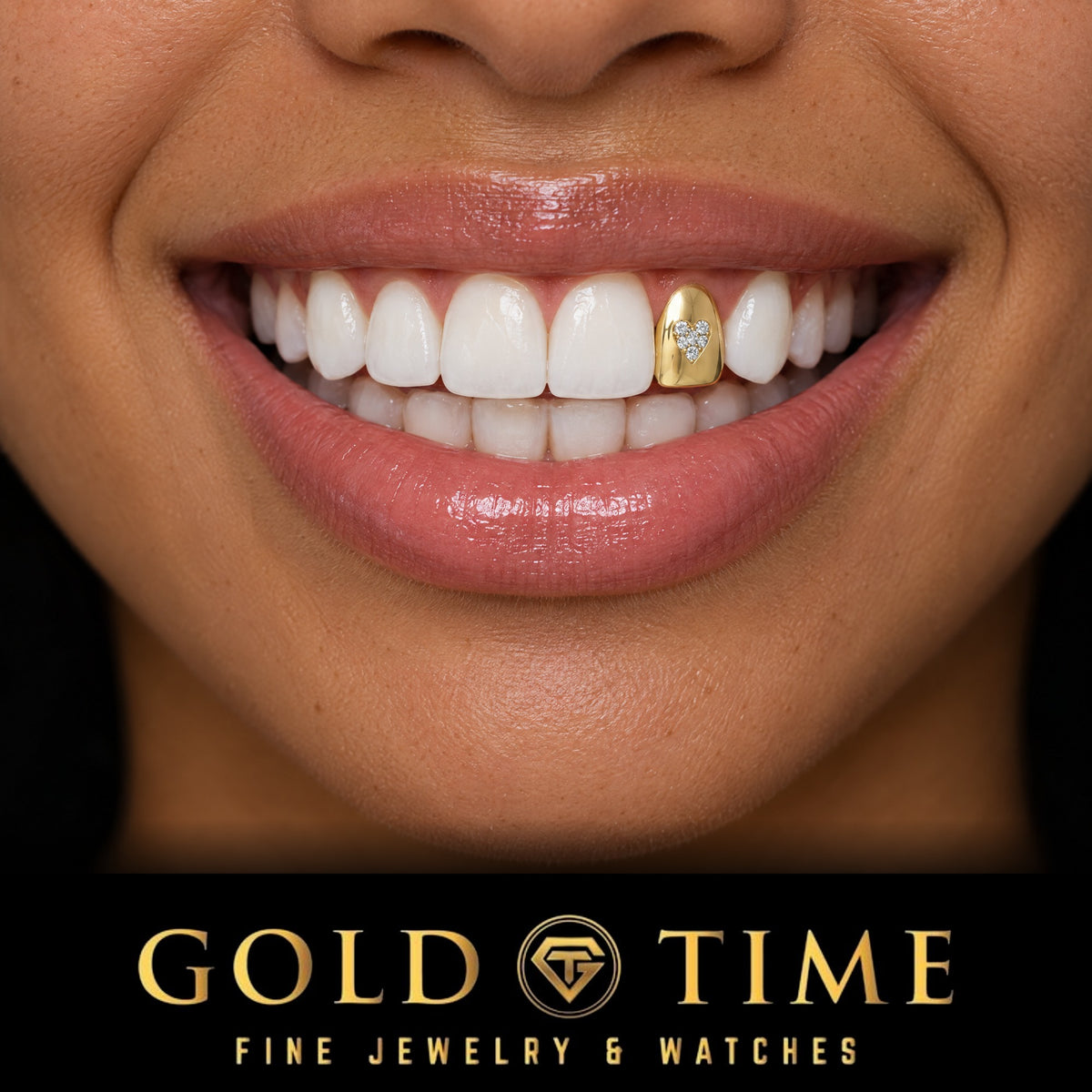 Woman smiling in a single yellow gold tooth cap set with a cubic zirconia heart, Gold Time