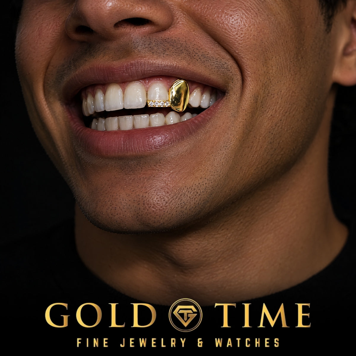Gold solid canine grill and moissanite tip worn on the upper left teeth, Gold Time