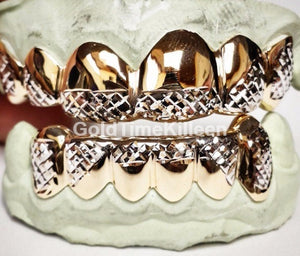 Close-up of yellow and white two-tone grillz with diamond-cut tips