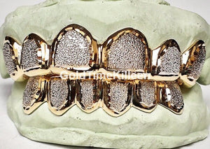 Top and bottom two-tone diamond dust box grillz with yellow gold frames on dental molds