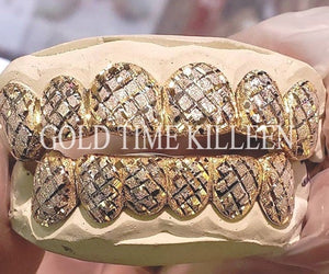 Close view of a two-tone trillion cut diamond dust grillz set held in hand