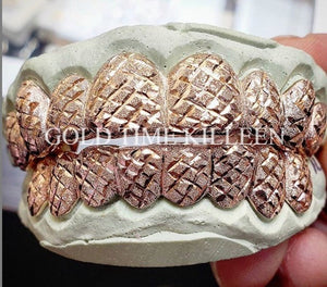 Rose and white two tone arctic cut grillz held in hand on a dental model, top and bottom