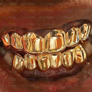 Close-up of a solid yellow gold grillz set worn on top and bottom teeth