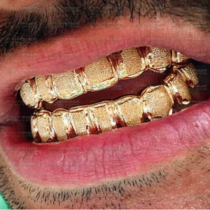 Rose and yellow gold diamond dust grillz worn on the top and bottom teeth