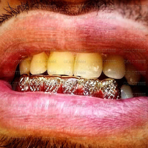 Yellow gold box trillion grillz worn on the lower teeth