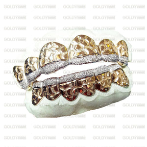 Top and bottom custom nugget grillz with diamond dust tips on molds