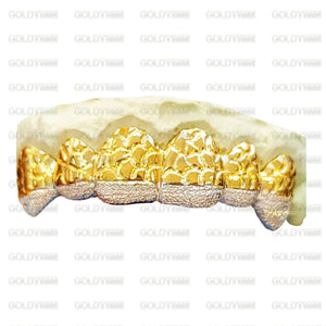 Custom yellow gold nugget grillz with a diamond dust band along the tips