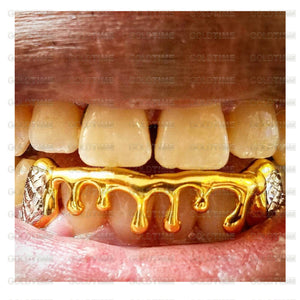 Close view of gold drip grillz worn in the mouth with stone set trillion cut box canines