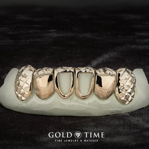 Custom 6 piece trillion cut grillz with solid canines and open face centers
