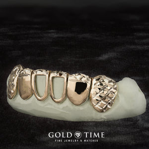 Side view of custom 6 piece trillion cut open face grillz