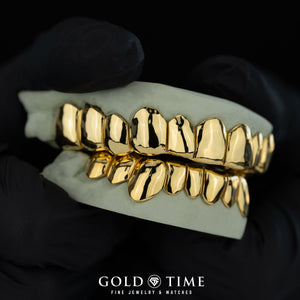 Gloved hand holding dental molds with yellow gold solid perm cut grillz top and bottom