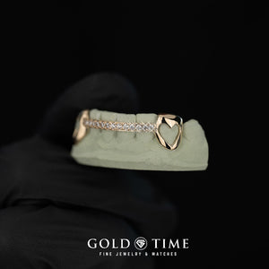 Gold grillz with heart design on a green mold against a black background, branded 'Gold Time'.