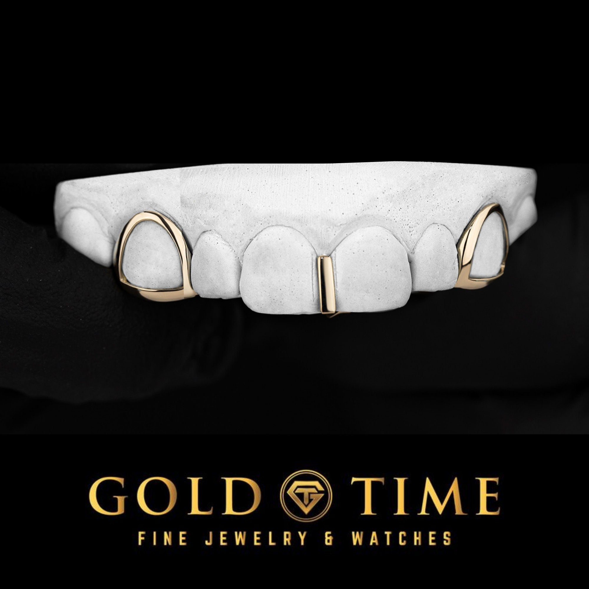 Custom 3-Piece Gold Grillz with Open Face Canines & Gap Bar
