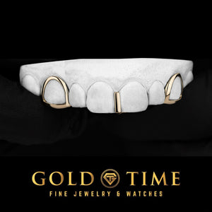 Rose gold 3 piece grillz on a mold: two open face canine frames and a slim gap bar between the front teeth