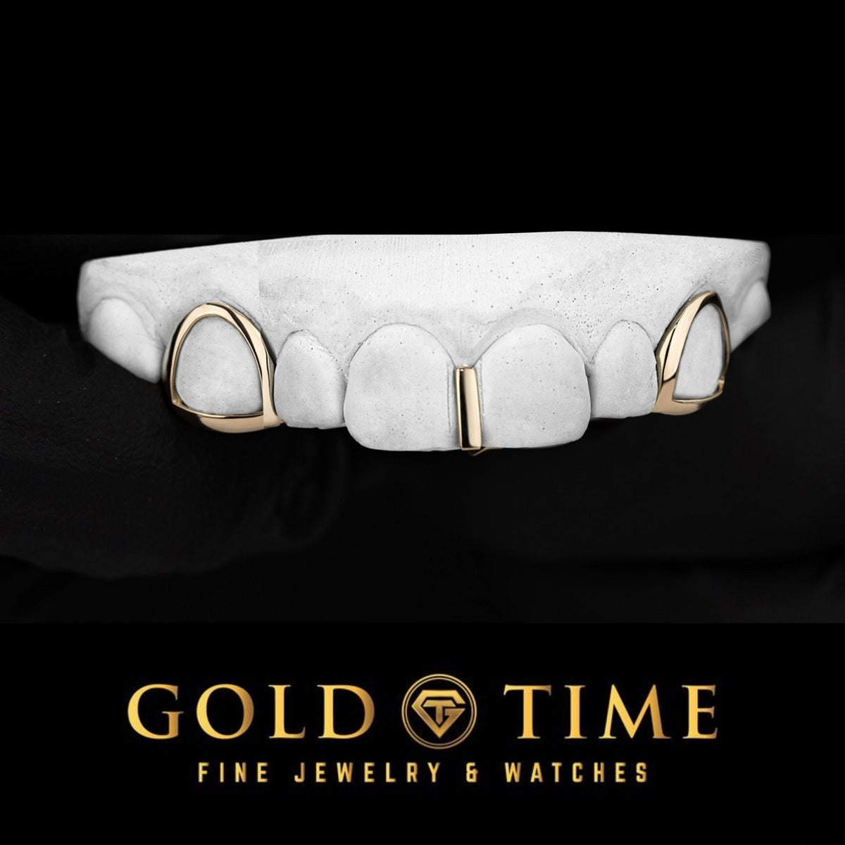 Custom 3-Piece Gold Grillz with Open Face Canines & Gap Bar