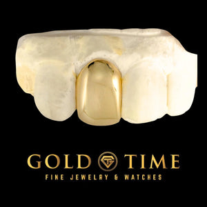 Front view of a solid yellow gold single tooth cap on a dental mold