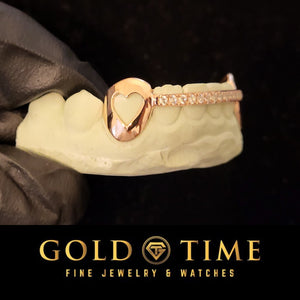 Rose gold heart-shaped grillz on a stone with 'Gold Time' branding.