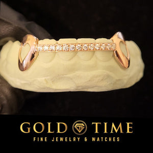 Rose gold dental grill with diamonds on a stone surface, branded 'Gold Time'.