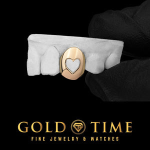 Yellow gold single tooth grillz cap with a heart shape cut out showing the natural tooth, on a dental mold