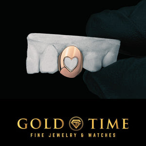 Rose gold single tooth cap with a heart shape cut out on a dental mold