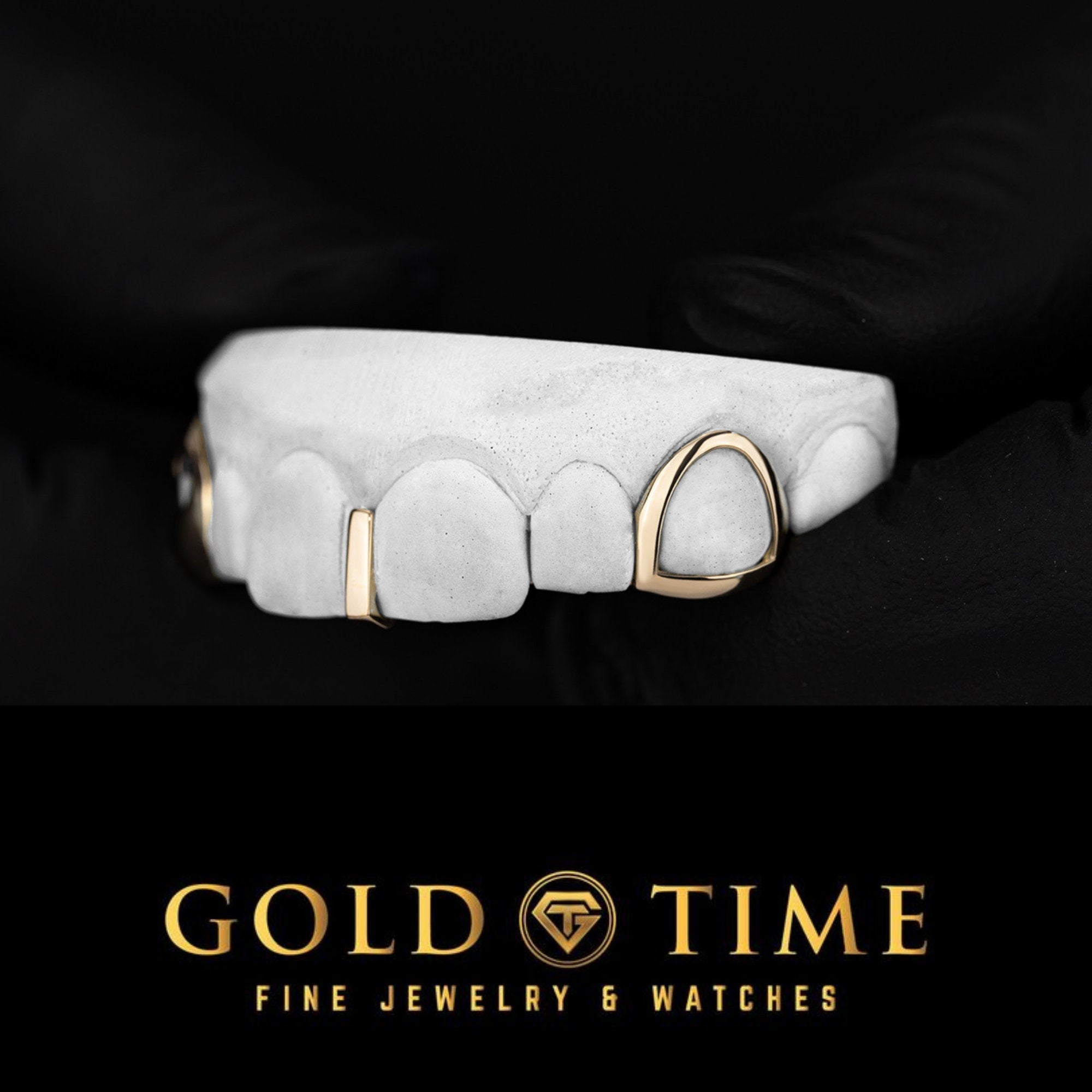 Custom 3-Piece Gold Grillz with Open Face Canines & Gap Bar