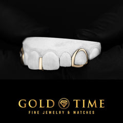 Custom 3-Piece Gold Grillz with Open Face Canines & Gap Bar