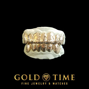 Wider view of the nugget top and bottom grill set on a dental mold